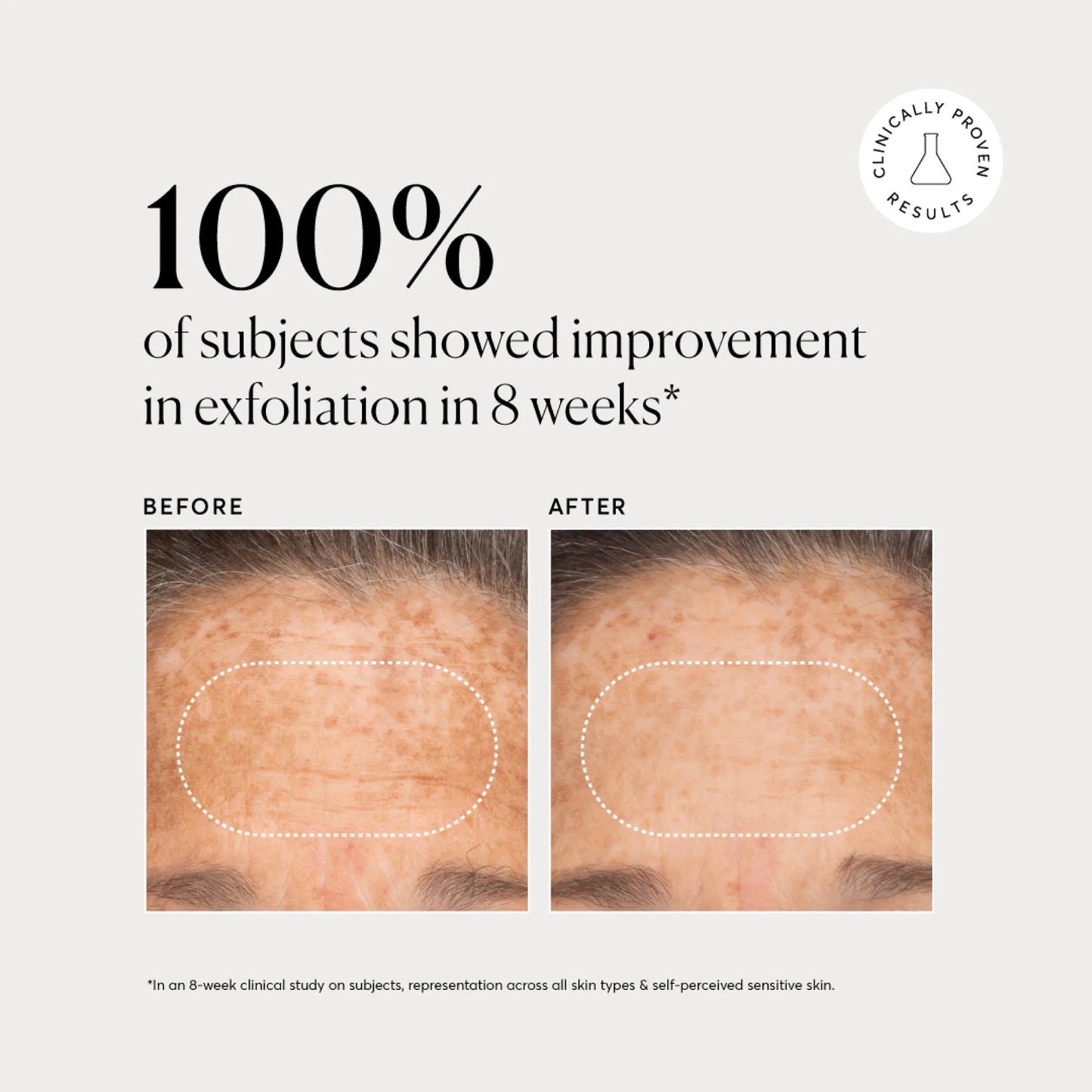 bha-liquid-exfoliant-2-y5 NATR-10027-Alt-Images-BHA-Liquid-Exfoliant-2_-03.webp